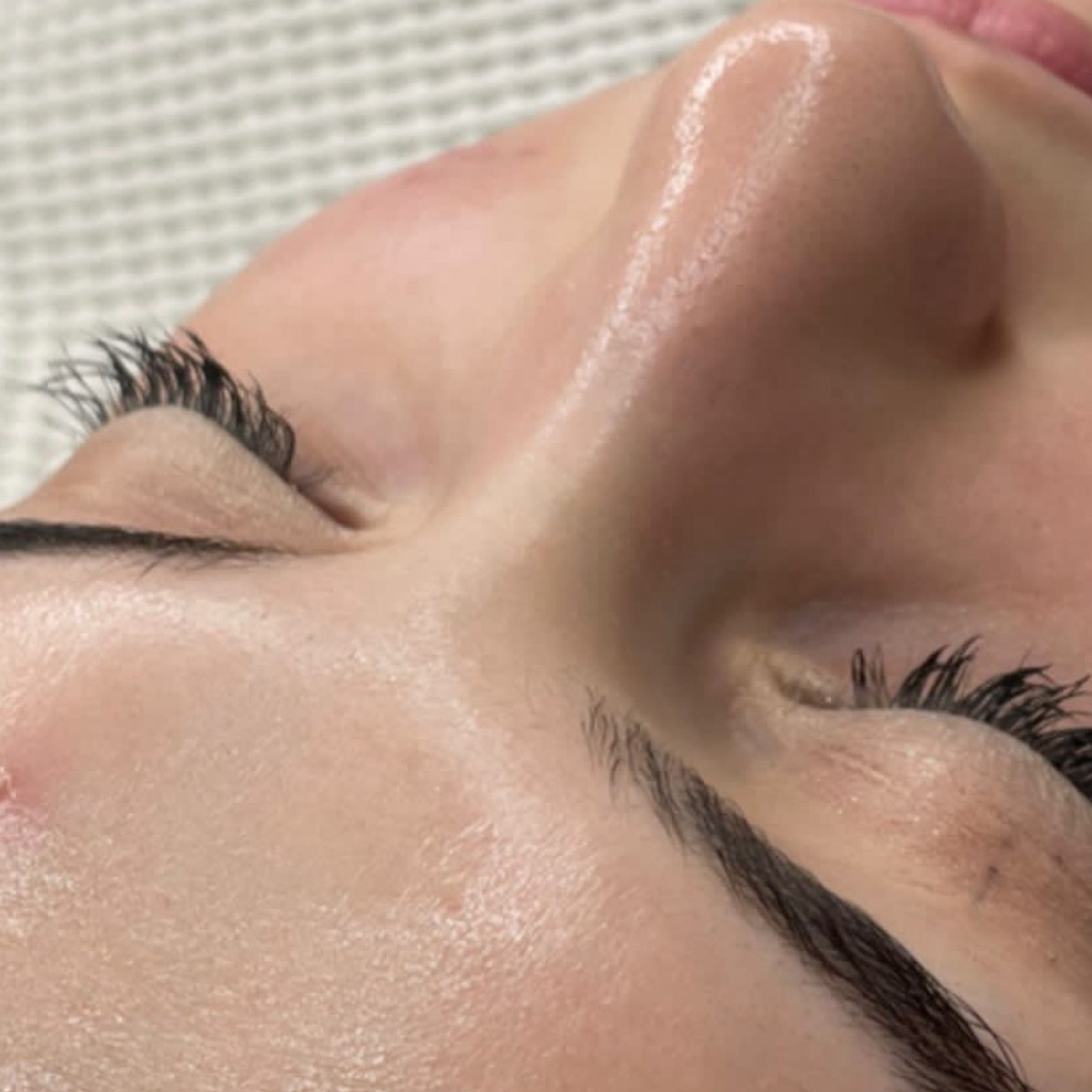 Чистка лица