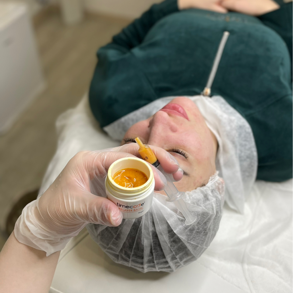 Пилинг сезонный