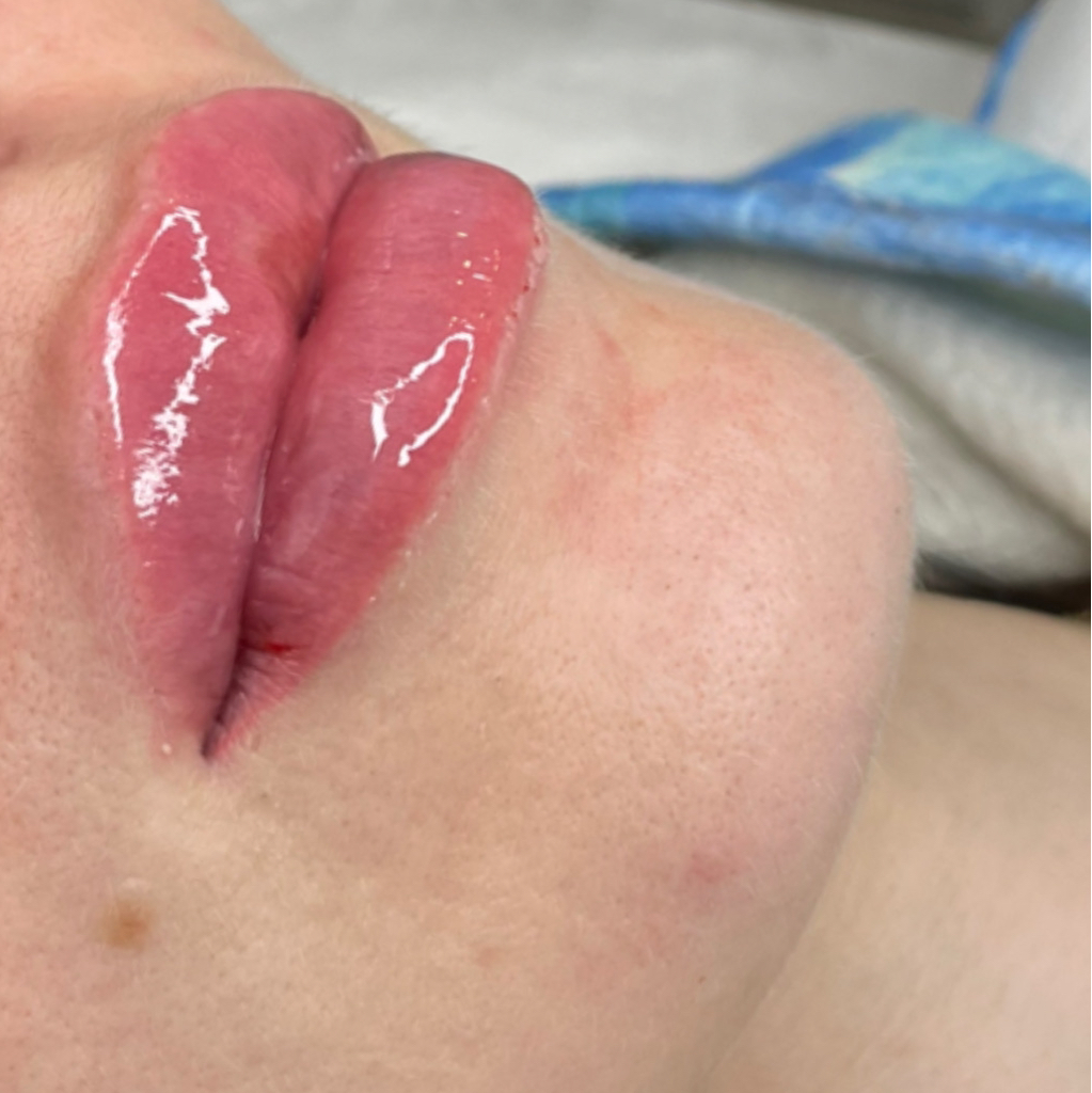 Увлажнение губ