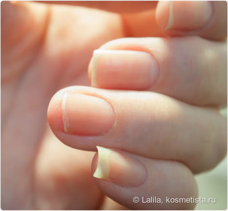 Ремонт 1 ногтя