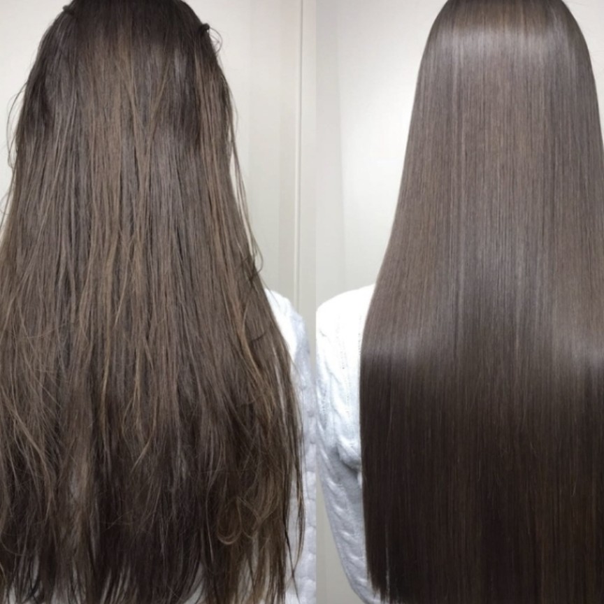 Биксипластия длинные волосы. Акция!!