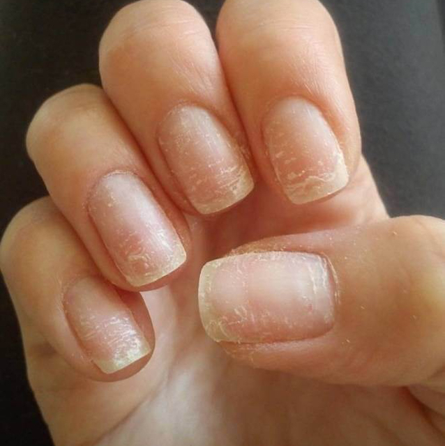 Снятие искусственного покрытия на ногтях