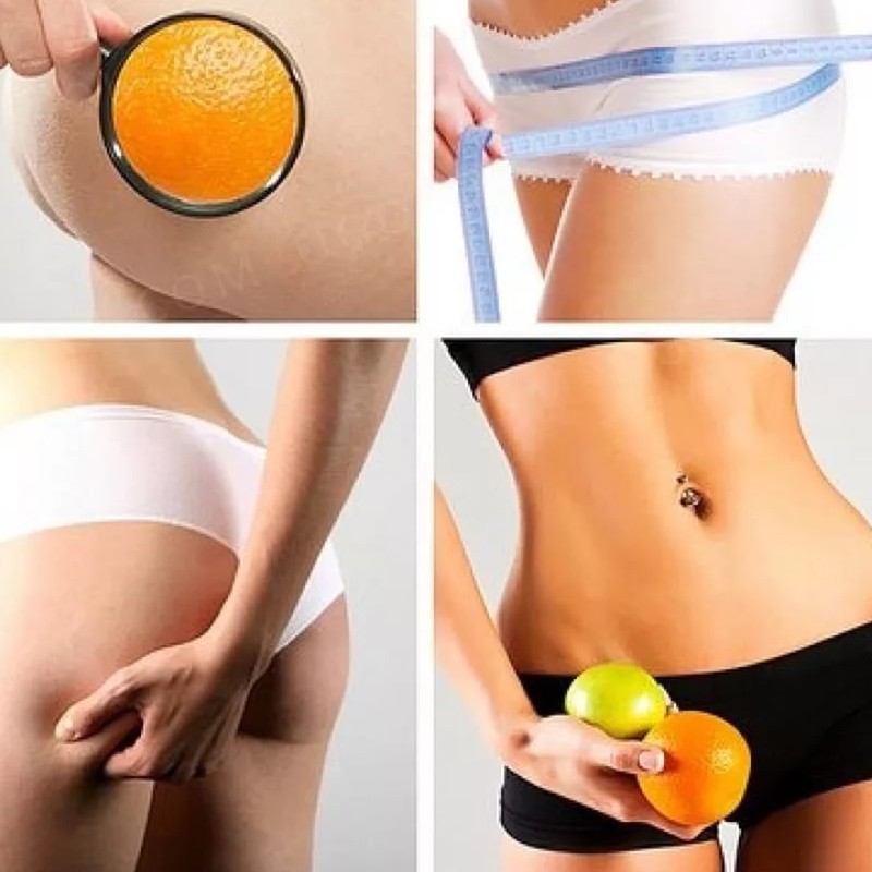 Антицеллюлитный массаж