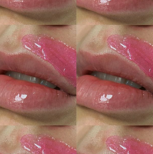 Эпиляция 1 зоны лица