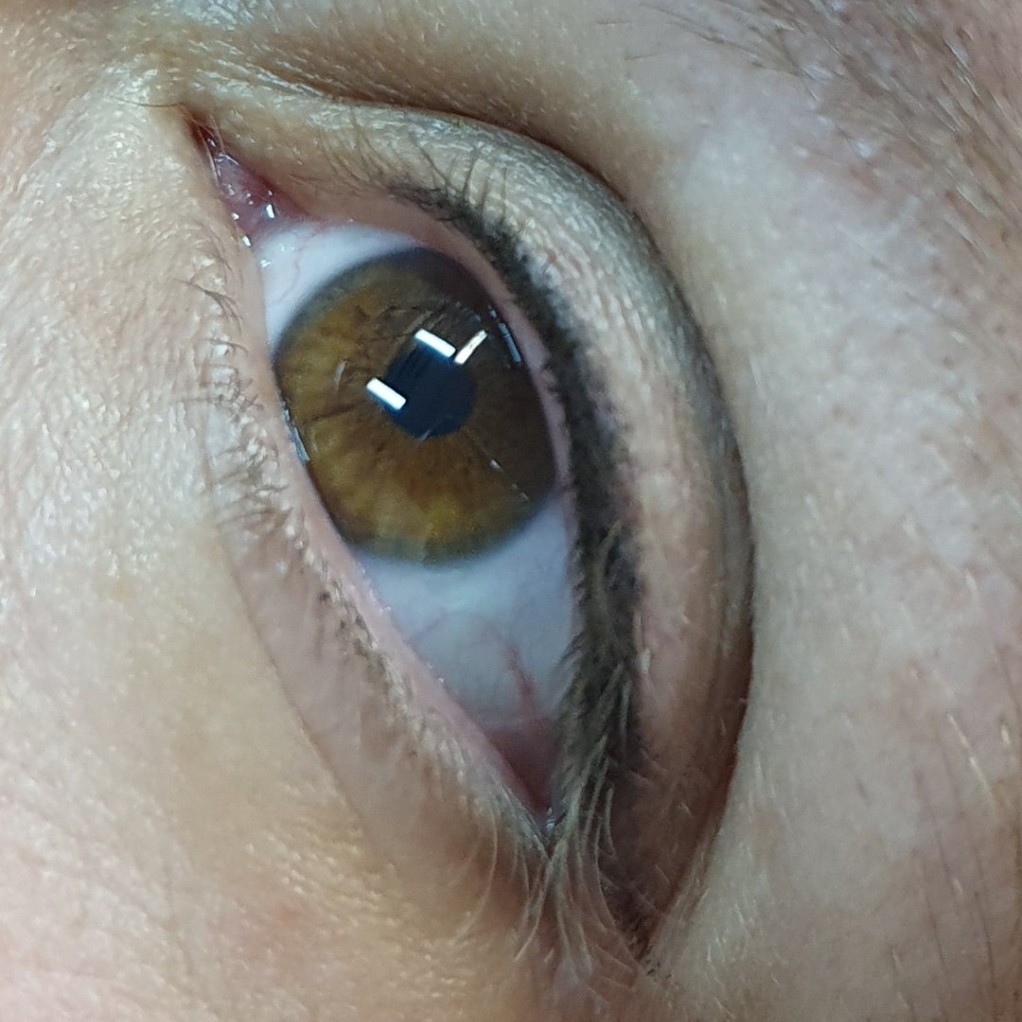 Коррекция татуажа межресничного пространства