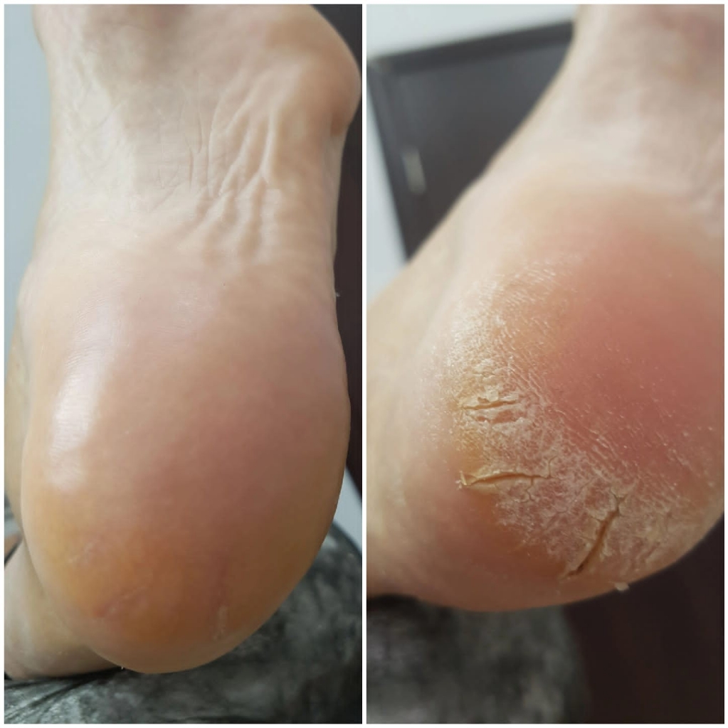 смарт педикюр полный(стопы+пальчики+гель-лак)