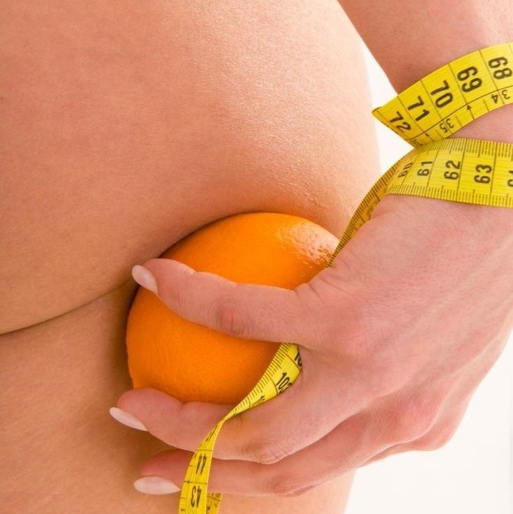 Антицеллюлитный массаж