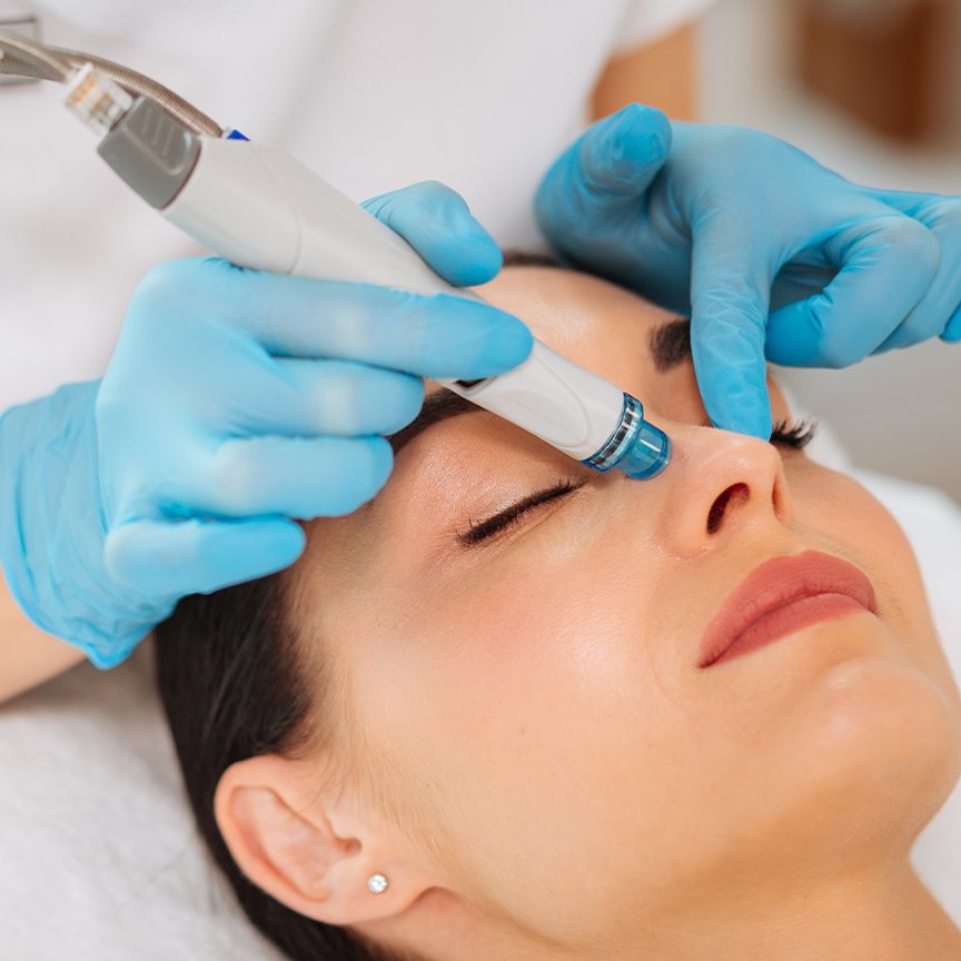 Фракционная мезотерапия