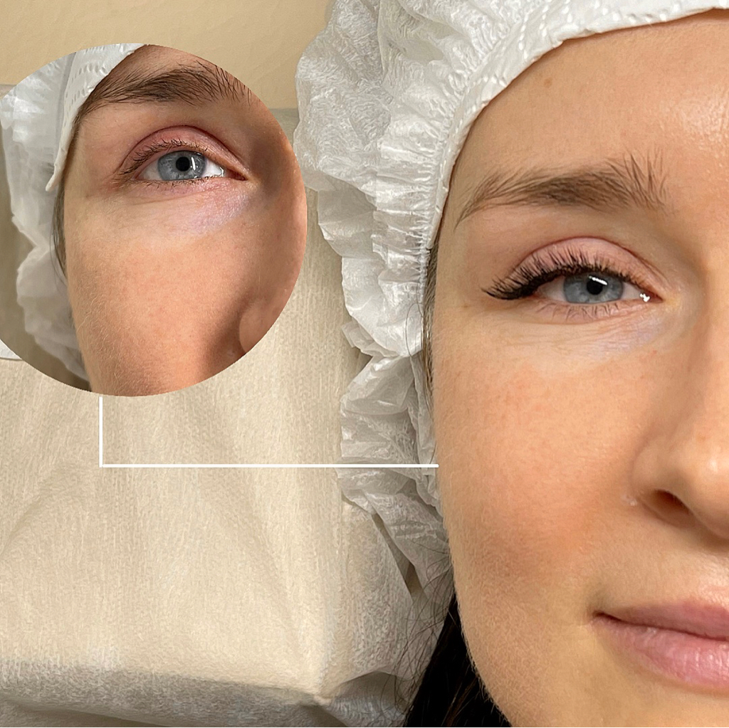 2Д Двойной обьем