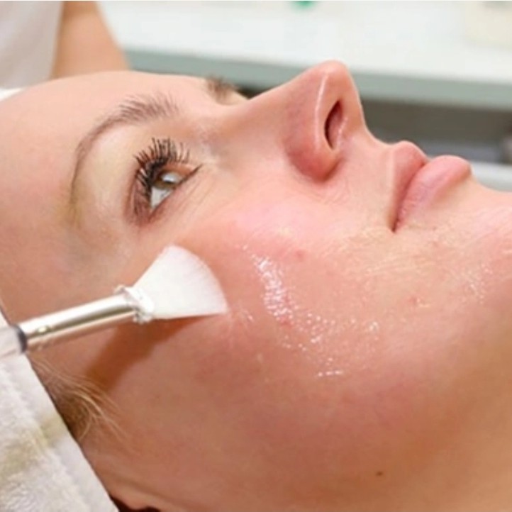 Химический пилинг