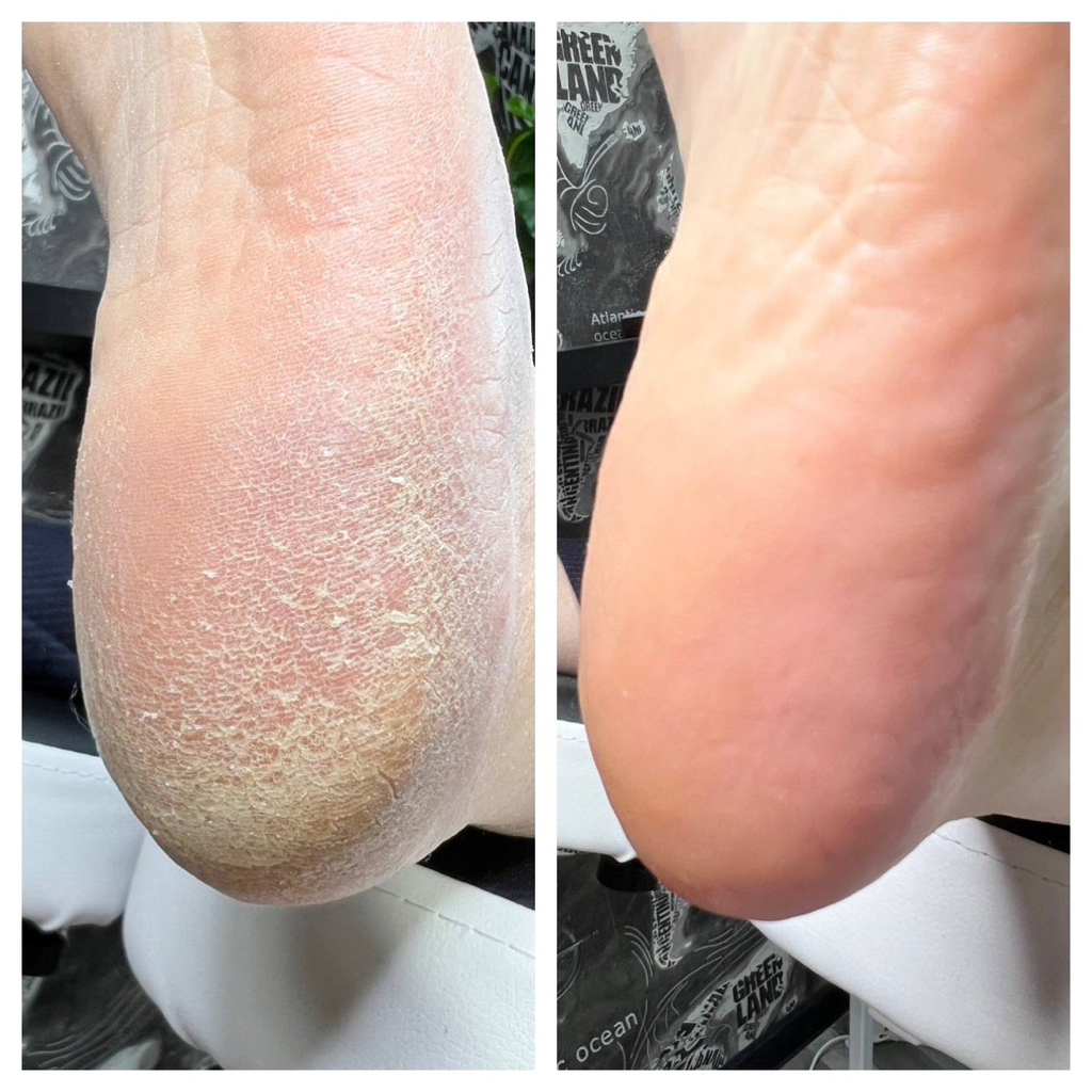 Смарт педикюр без покрытия.