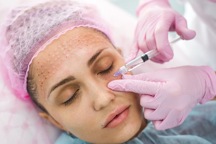 Мезотерапия (периорбитальная область)