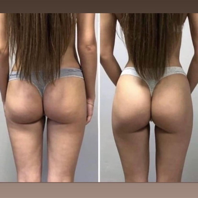 Коррекция фигуры