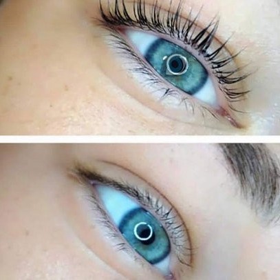 Ботокс ресниц