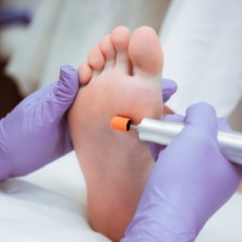 Педикюр(обработка стоп)