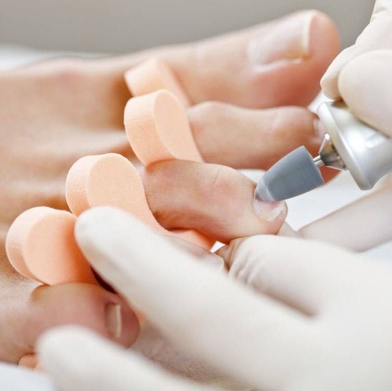 Педикюр (обработка пальчиков)