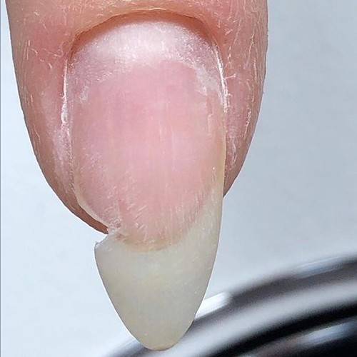 Ремонт (1 ноготь)