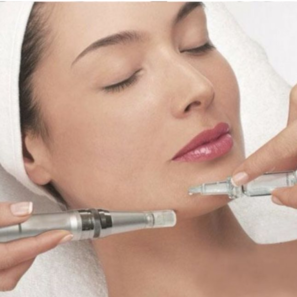 Фракционная мезотерапия( лицо )