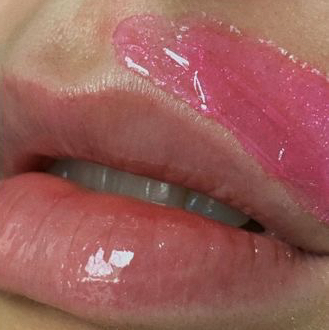 Ваксинг верхней губы