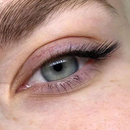 Уголки наращивание