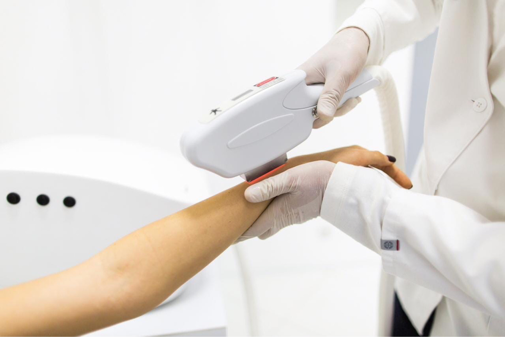 Лазерная эпиляция-руки полностью