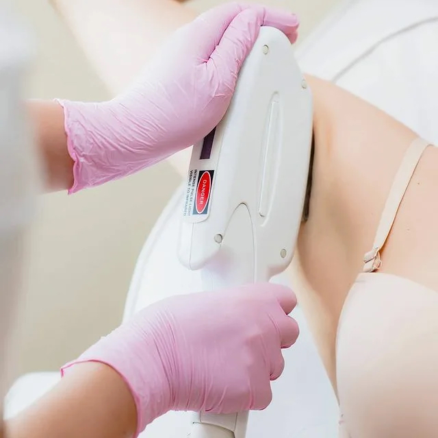 Лазерная эпиляция подмышечные впадины