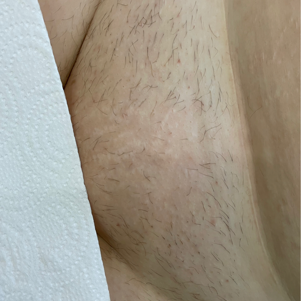 Глублкое бикини