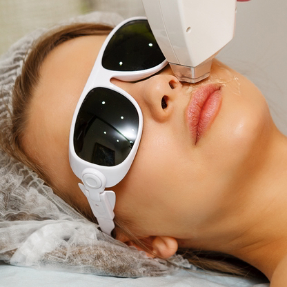 Лазерная эпиляция-Усы