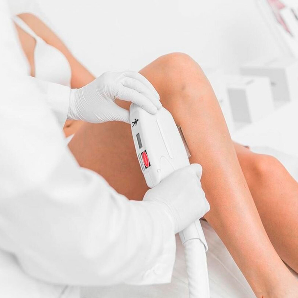 Лазерная эпиляция ног