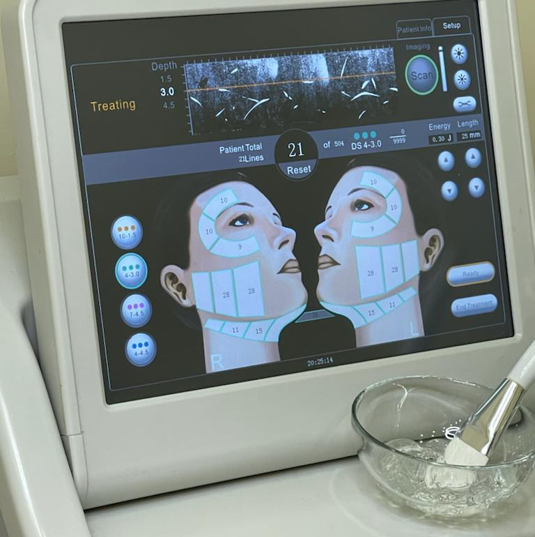 Смас лифтинг