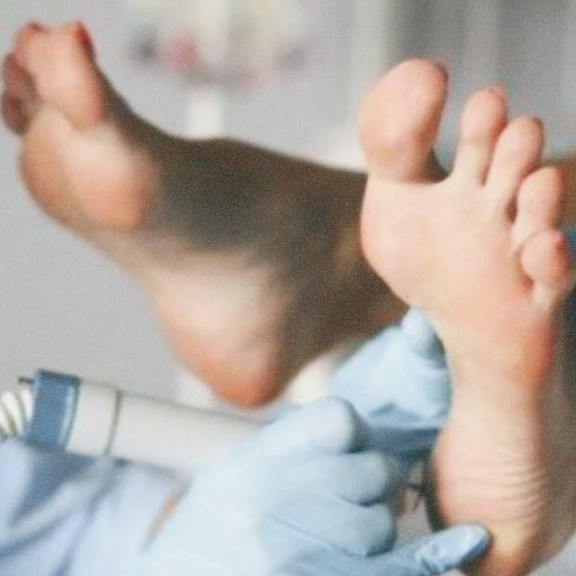 Медицинский педикюр