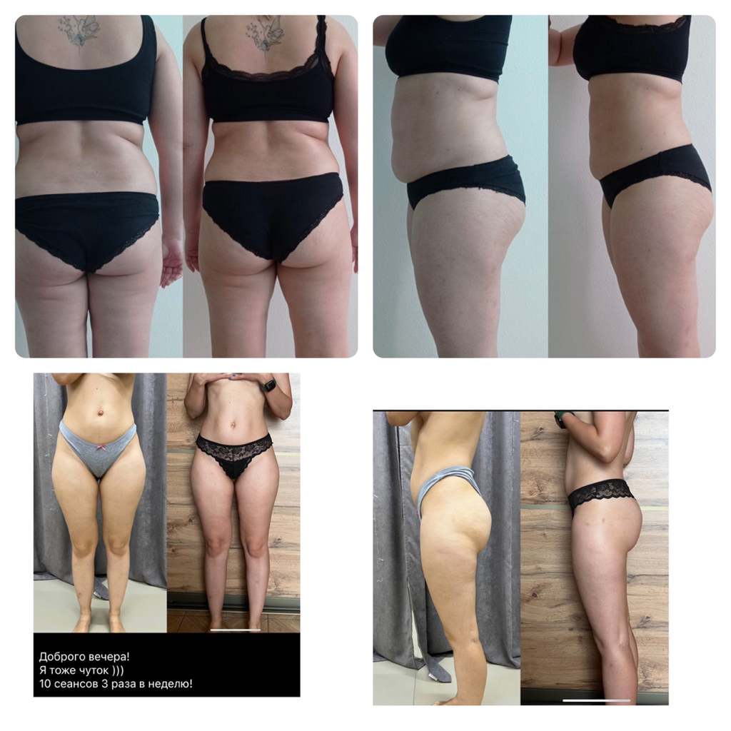 Мадеротерапия живот