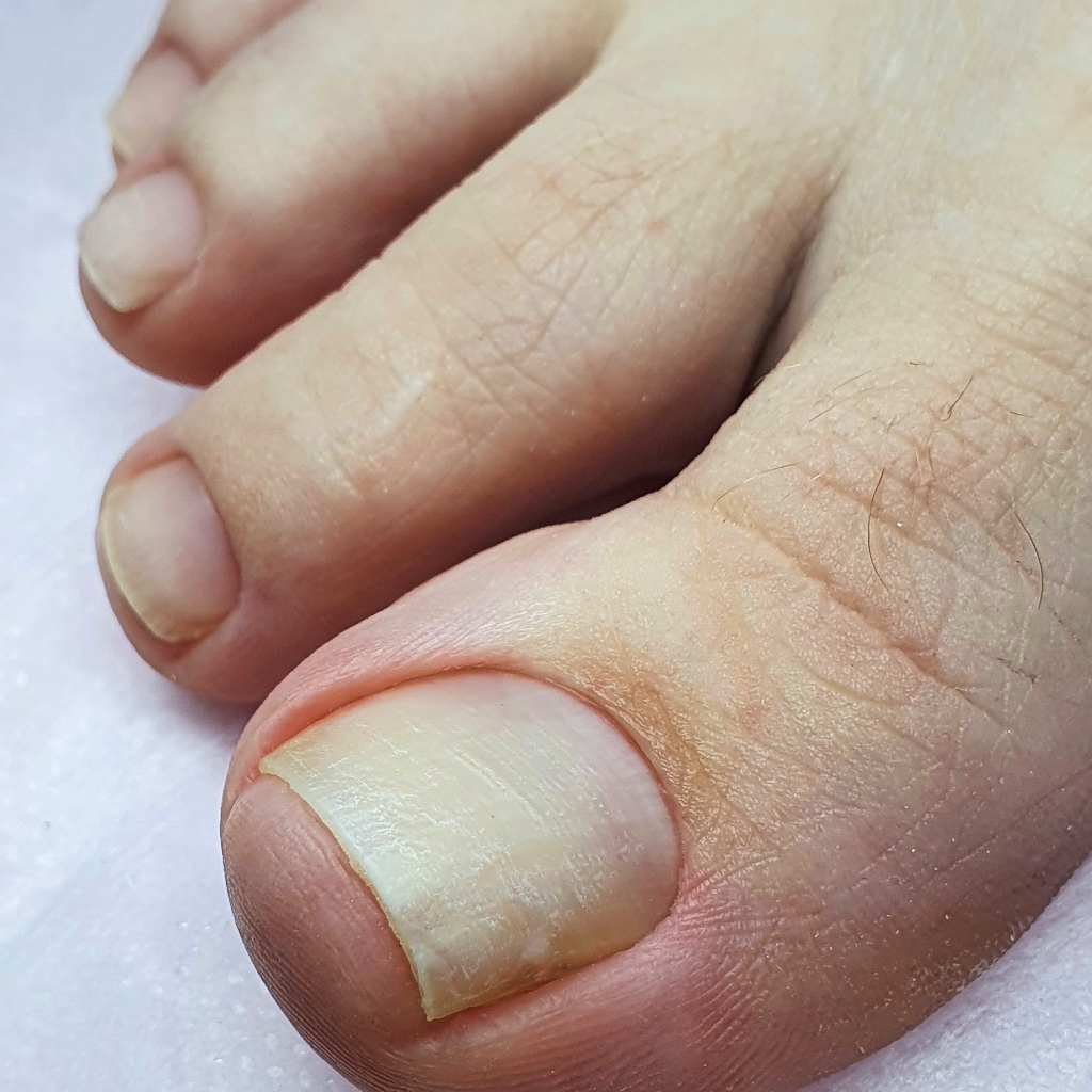 гигиенический педикюр