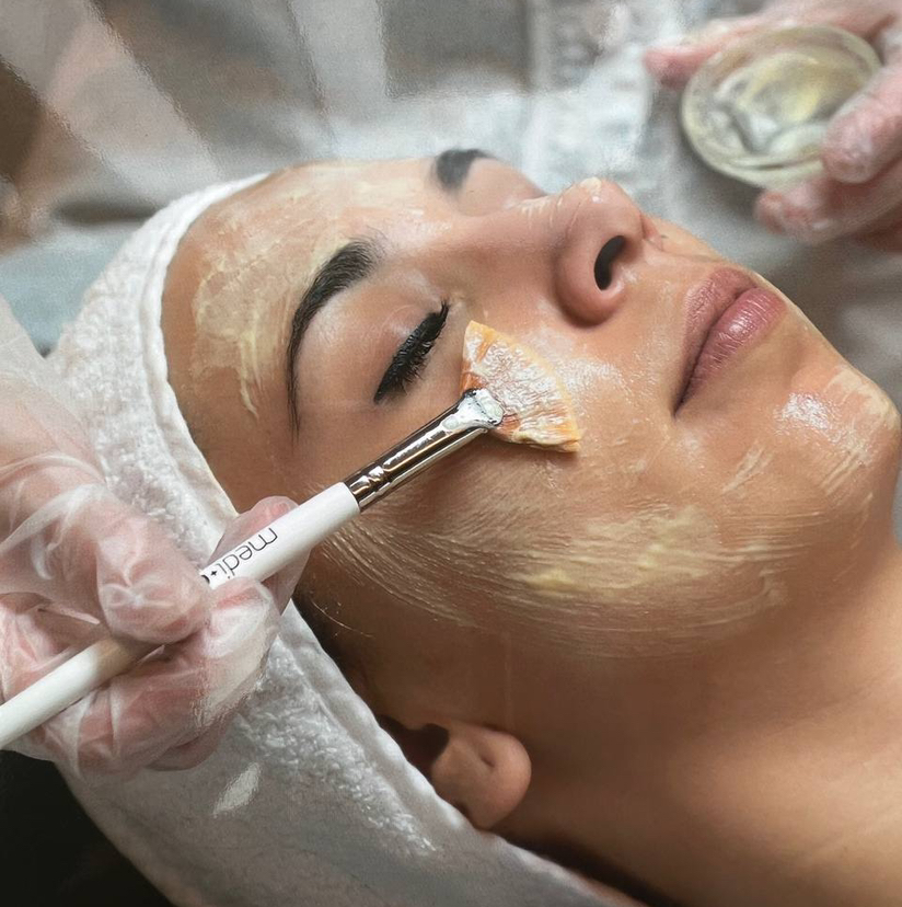 Механическая чистка лица