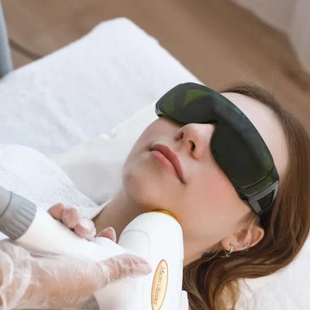 Лазерная эпиляция малой зоны (верхняя губа (усики) /щека/межбровье/подбородок)