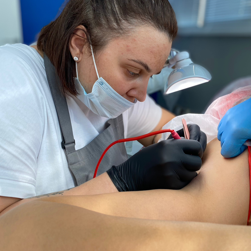 Часовая электроэпиляция