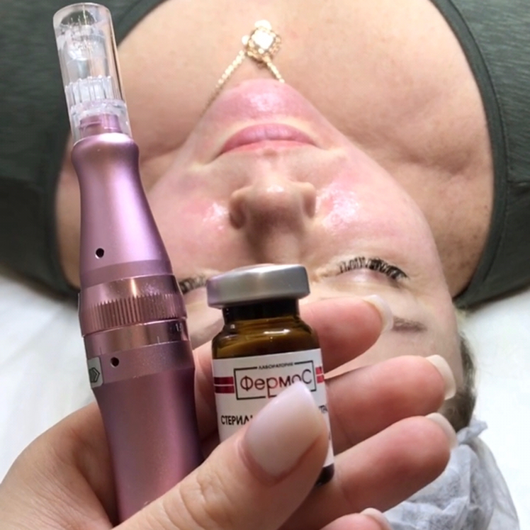 Антикупероз Ar delicate arkadia