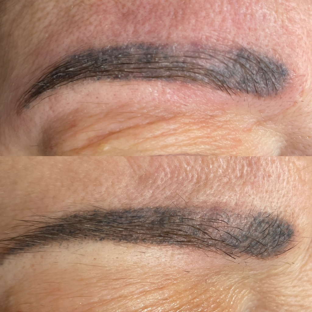 Удаление перманентного макияжа ремувером