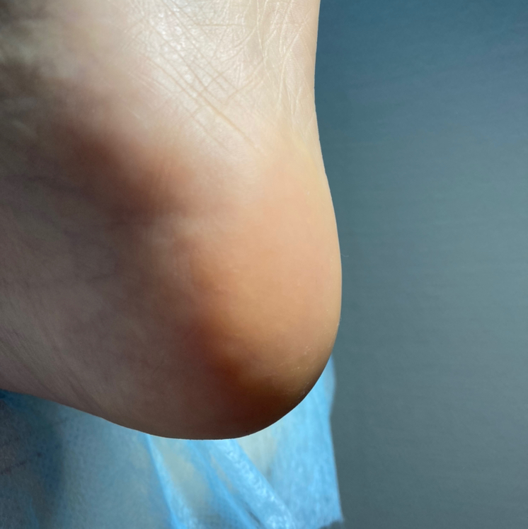 Педикюр пилинг с обертыванием   Golden trace без покрытия