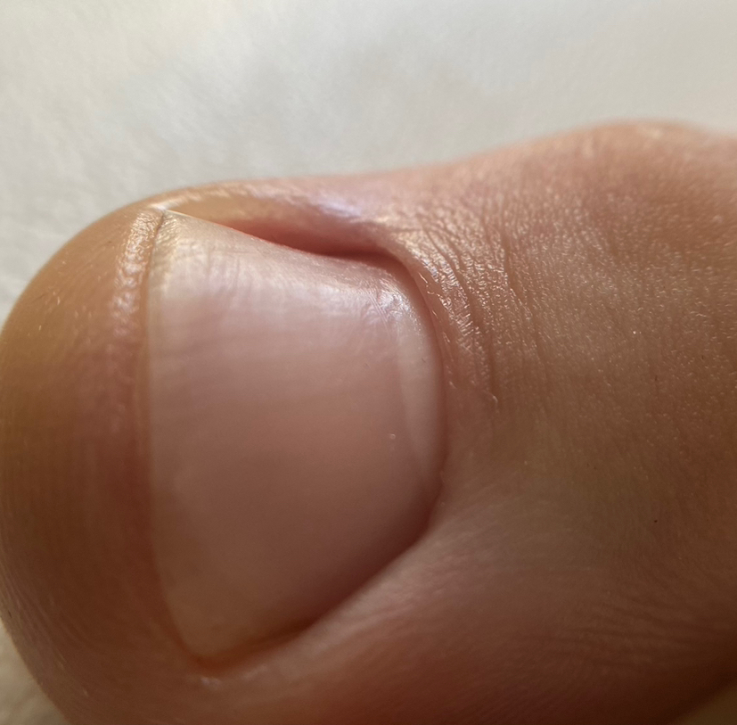 Экспресс педикюр