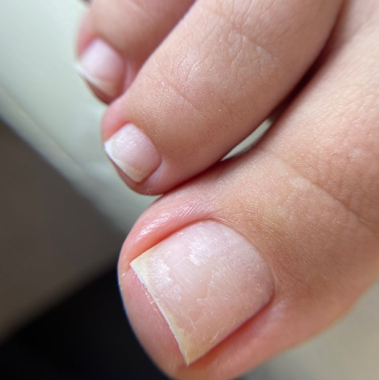 Снятие гель-лака с ног + полировка бафом