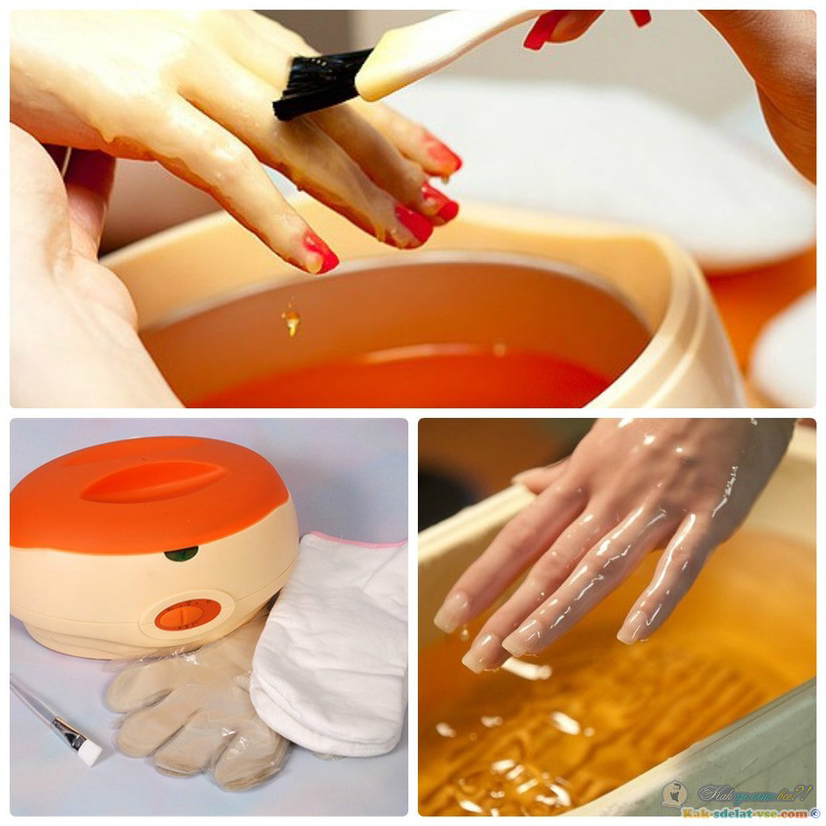 Парафинотерапия