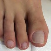 Гигиенический педикюр пальчиков