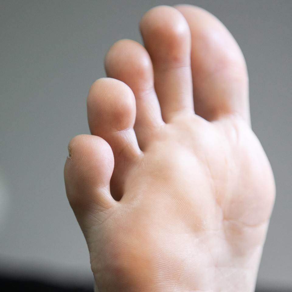 Гигиенический педикюр стоп и пальчиков