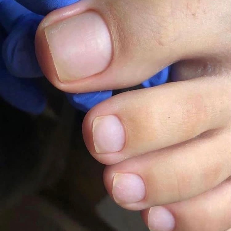 Педикюр (обработка только ПАЛЬЧИКИ)