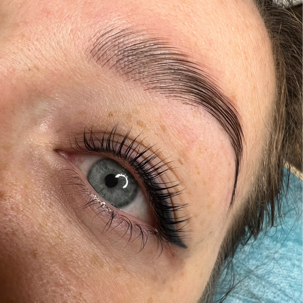 Комплекс Лами