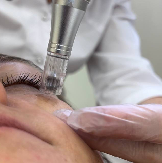 Фракционная мезотерапия лицо+шея