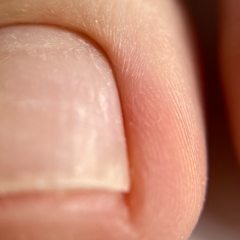 Обработка пальчиков ног