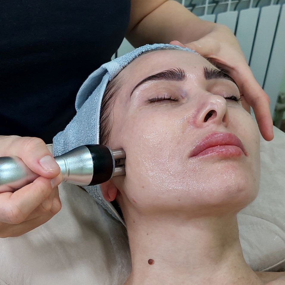 RF-ЛИФТИНГ ЛИЦО, ШЕЯ, ДЕКОЛЬТЕ