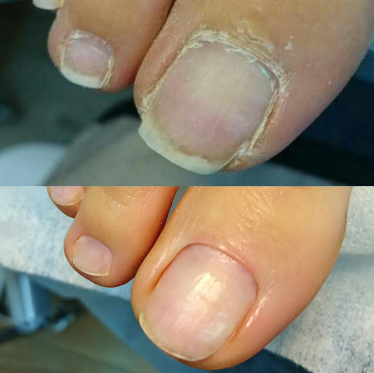 Педикюр гигиенический(без каких либо критичных проблемных зон,трещины,мозоли,изменения ногтей…)